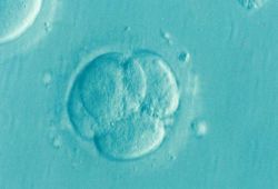 in vitro peterborough cambridgeshire